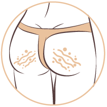 integratore cellulite