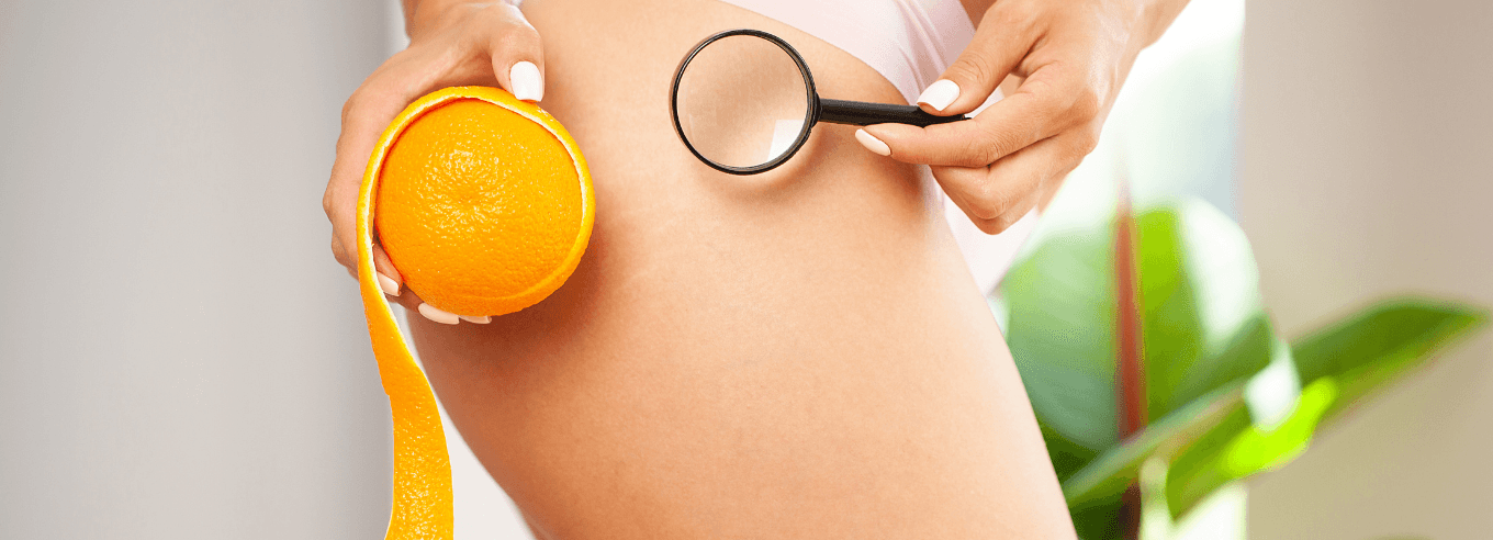 pelle a buccia d'arancia inestetismi della pelle integratore ritenzione idrica integratore cellulite cellulite cause